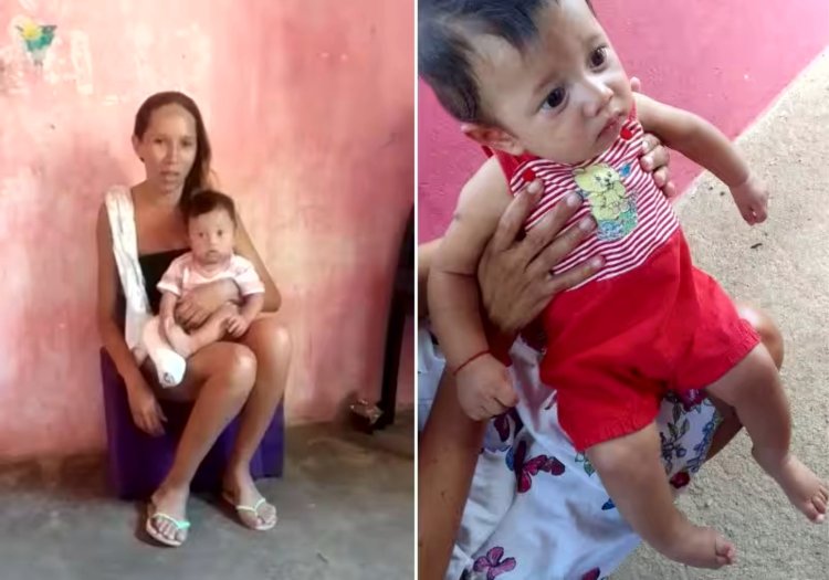 Emocionada, mãe pede botinha ortopédica para bebê com pé torto congênito