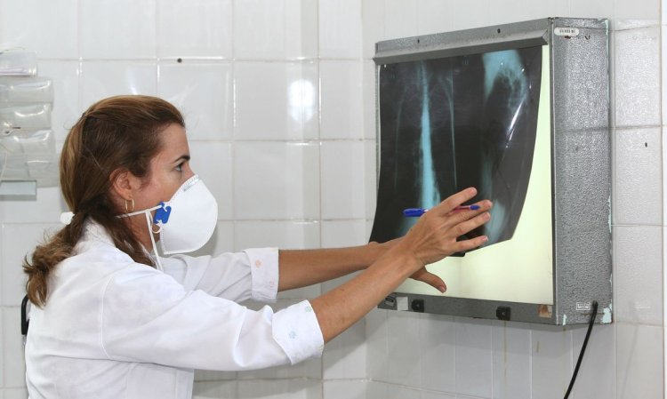 Em menos de 3 meses, Arcos registra 2 novos casos de tuberculose